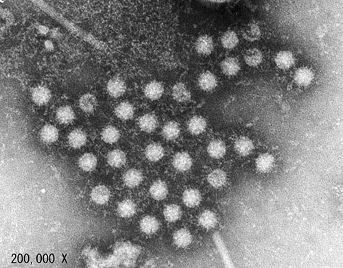Combating the Norovirus Outbreak (Norwalk Virus)