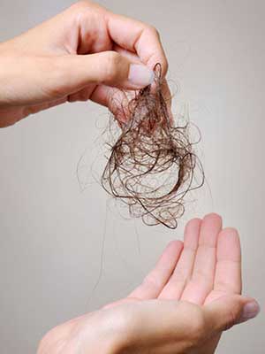 Thinning Hair – Female Hair Loss: What You Should Do