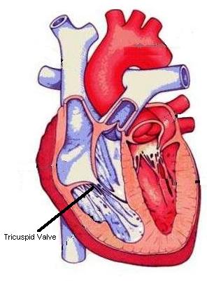 Valvular Heart Disease: What You Need to Know